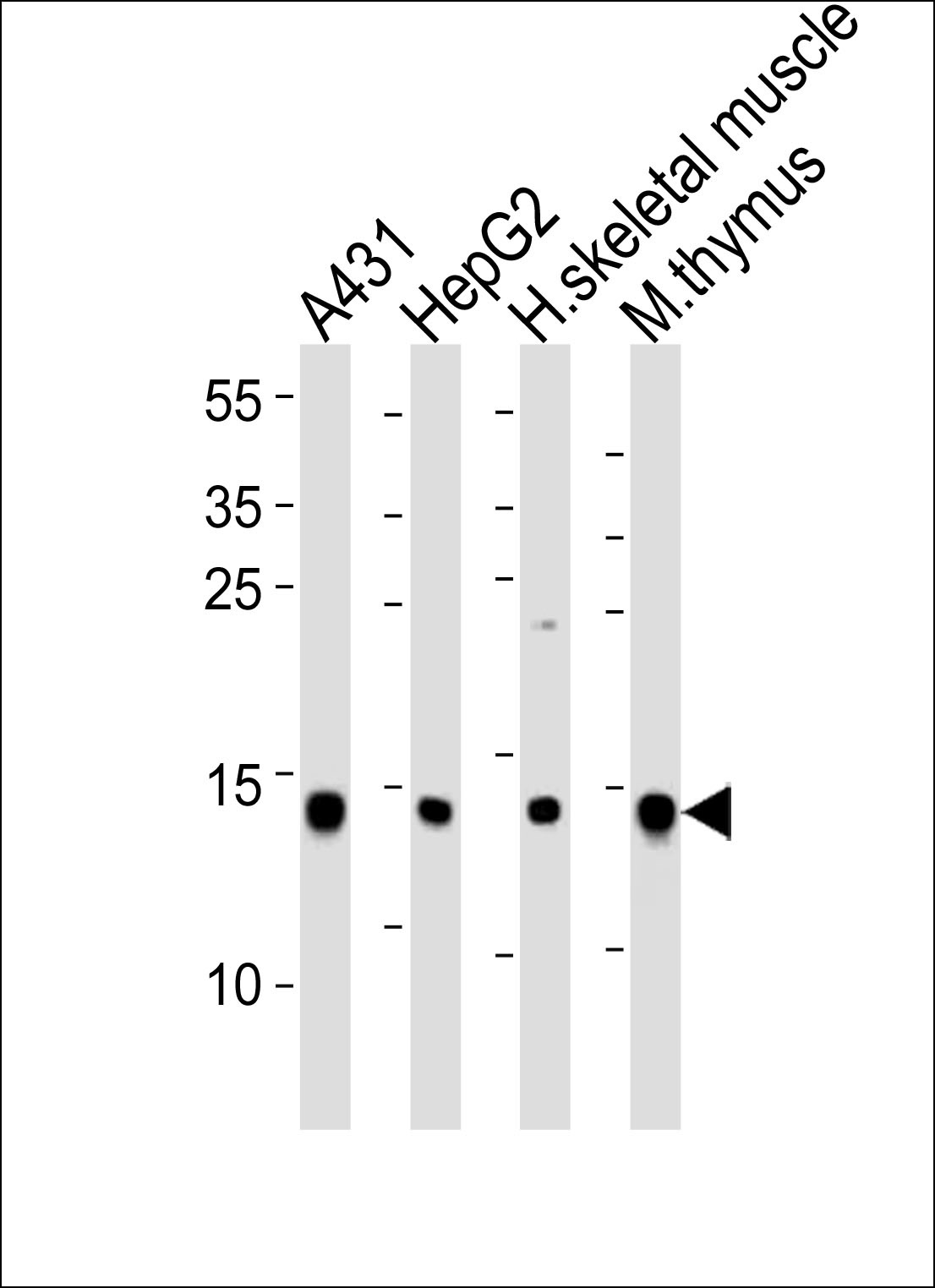 UBE2D1 Antibody