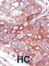 UBE2D1 Antibody