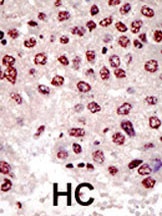 UBE4B Antibody