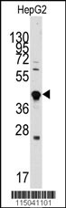 GDF3 Antibody