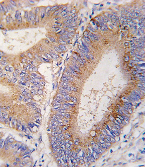 GDF11 Antibody