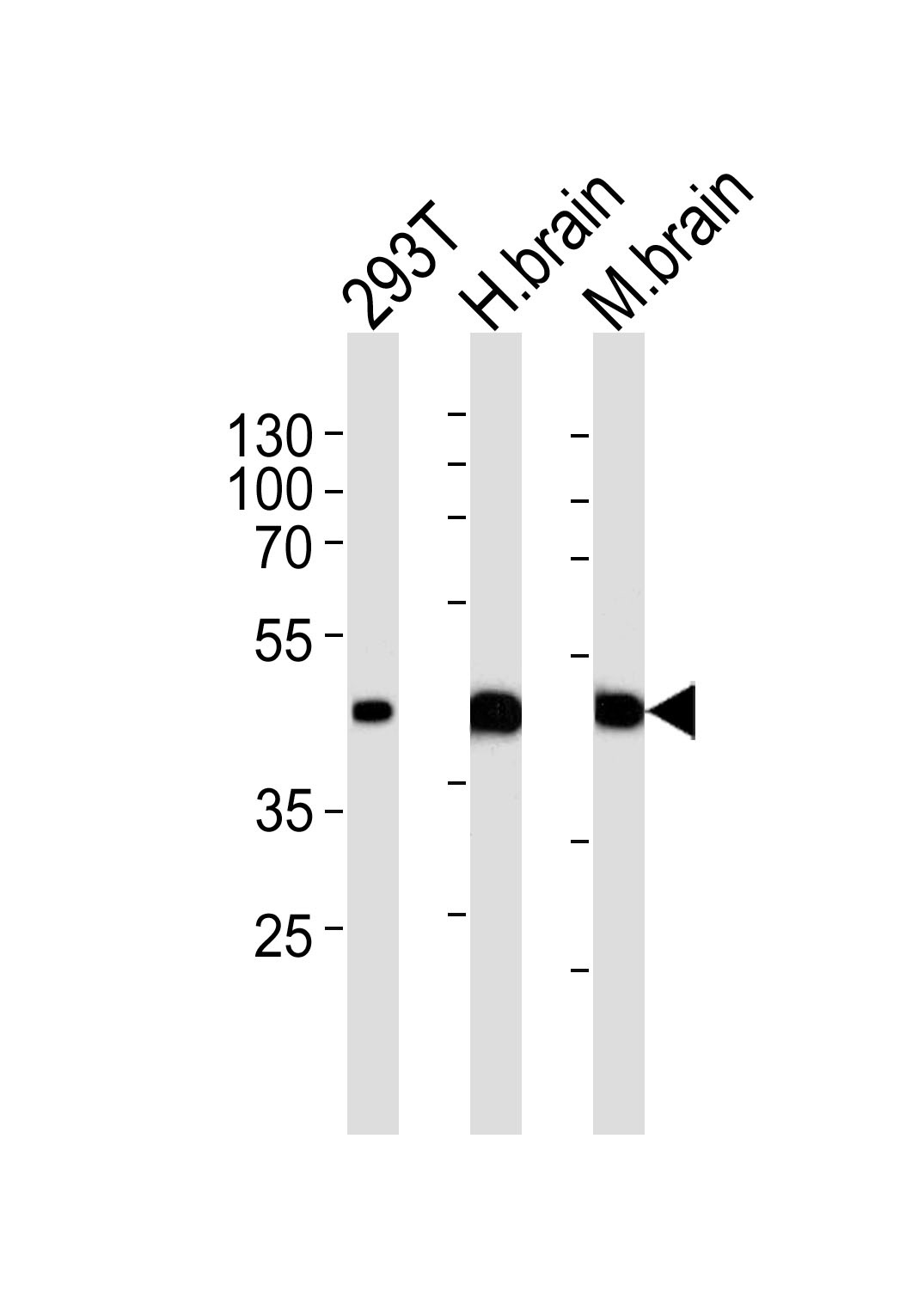 STRADA Antibody