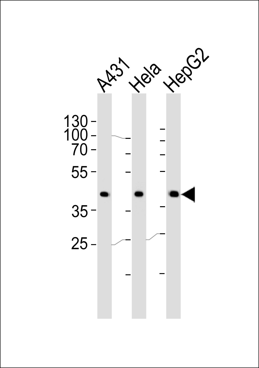 CSNK2A1 Antibody