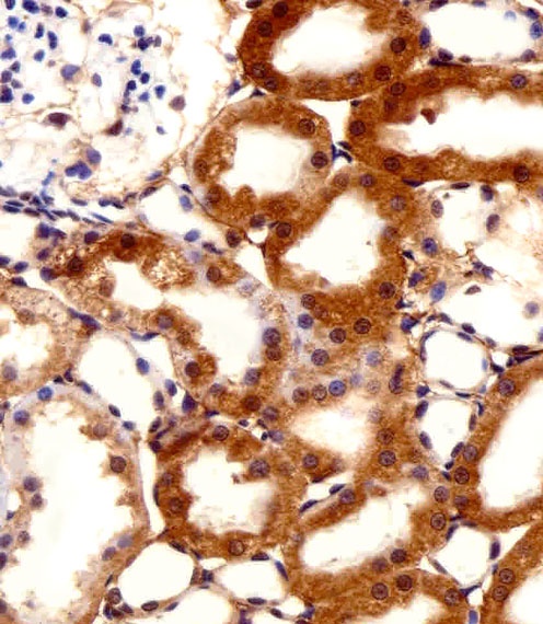 FBXL17 Isoform 2 Antibody