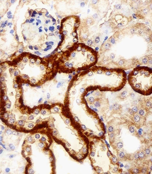 FBXL17 Isoform 2 Antibody