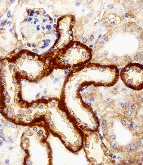 FBXL17 Antibody