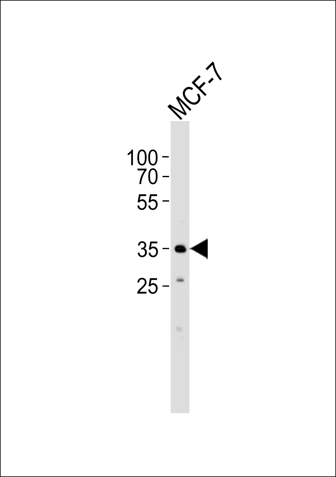 FBXL17 Antibody