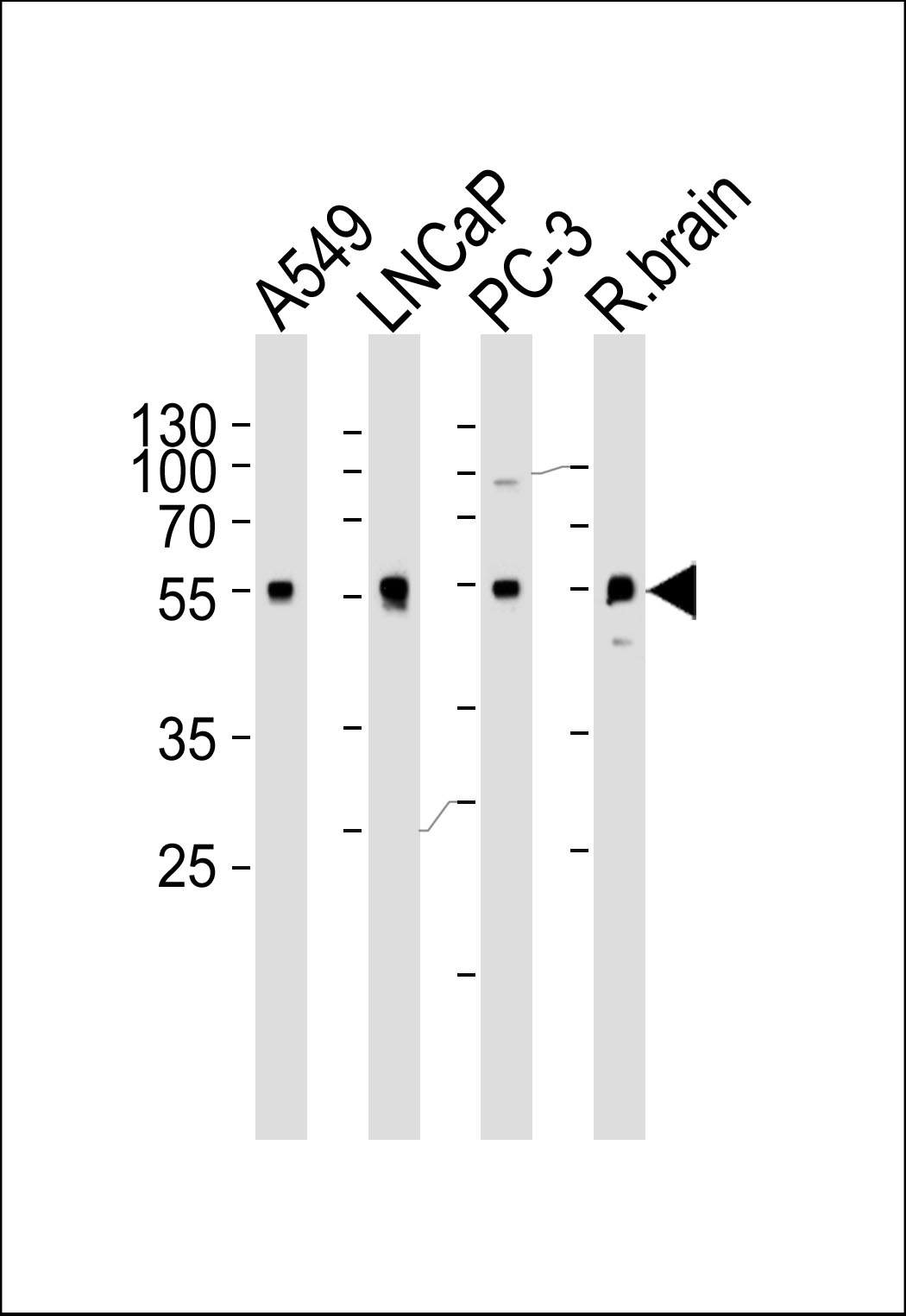 ADRA1D Antibody