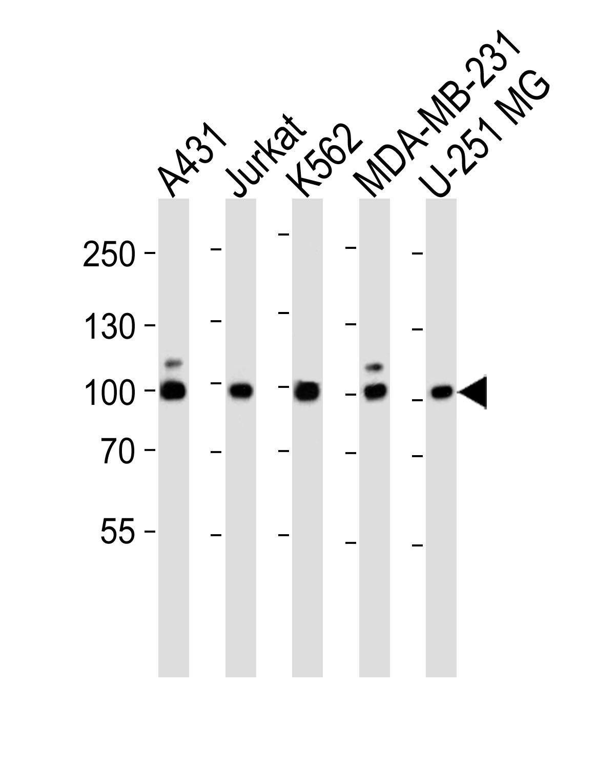 ZNF175 Antibody