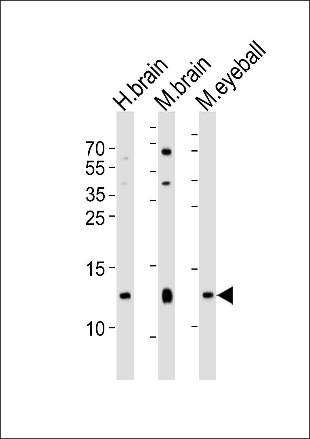 HBG2 Antibody