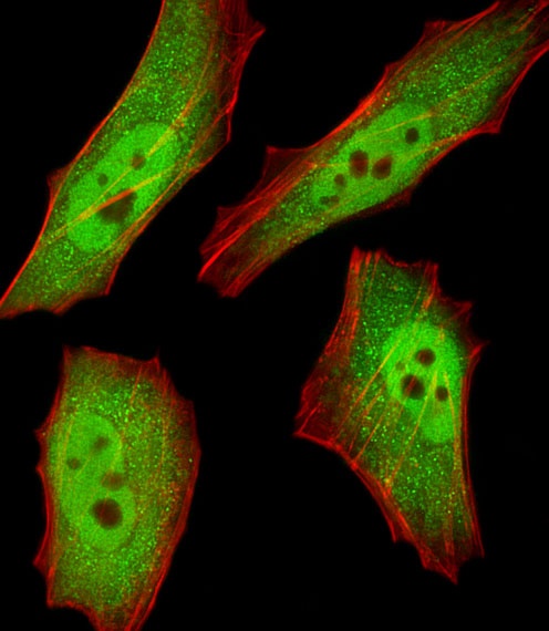 RBX1 Antibody