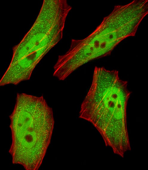 RBX1 Antibody