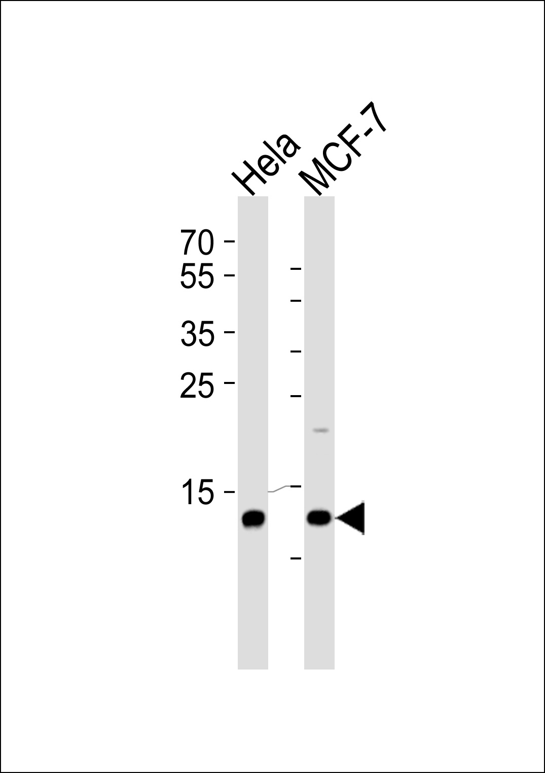 RBX1 Antibody