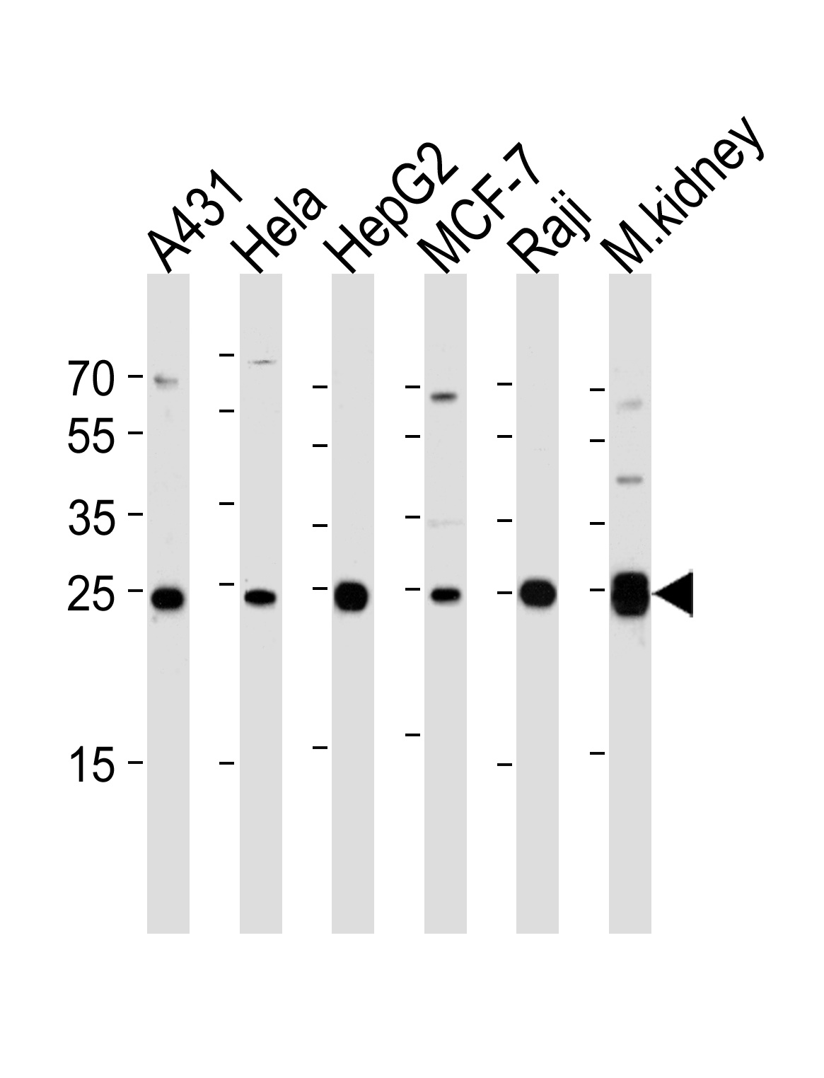 AK4 Antibody