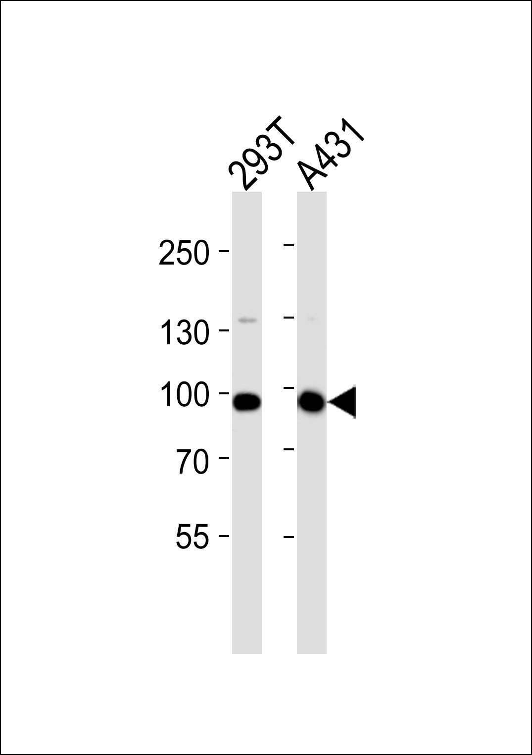 IL4R Antibody