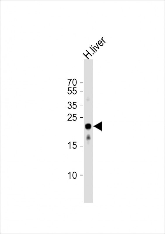 MMAB Antibody