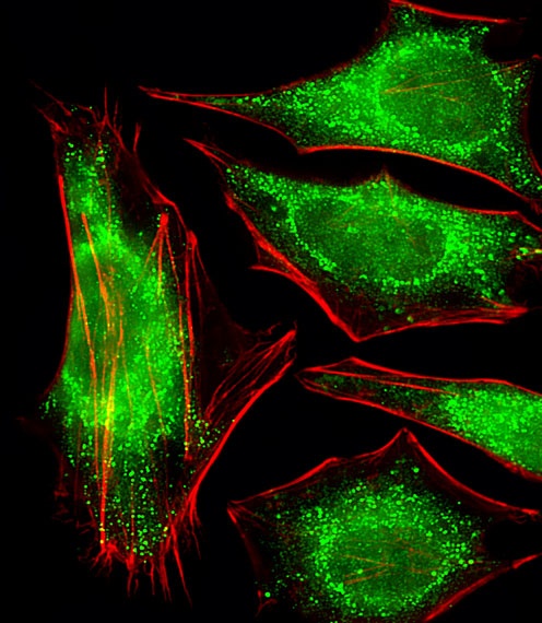 PPP2R2A Antibody