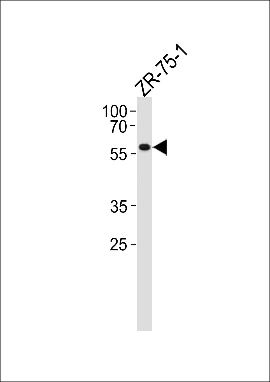 PPP2R2A Antibody