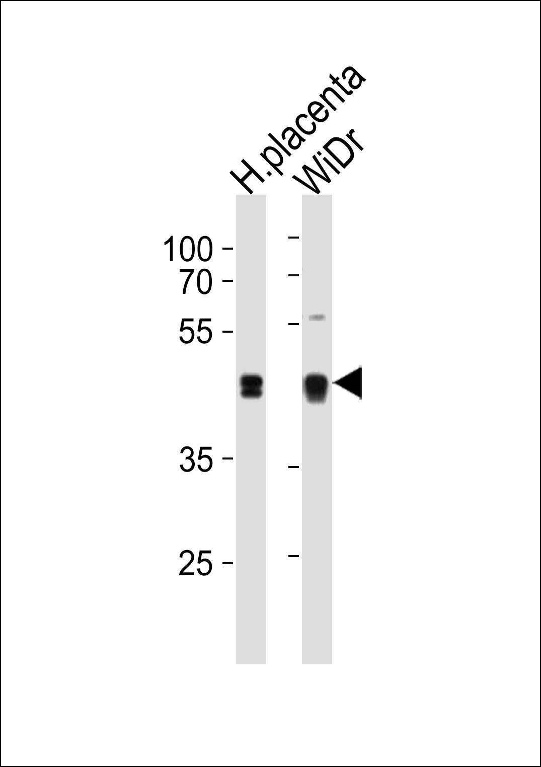 SAP30BP Antibody