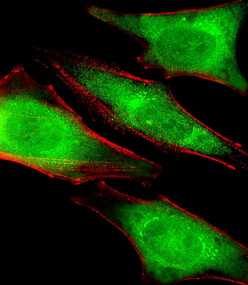 PSMC1 Antibody