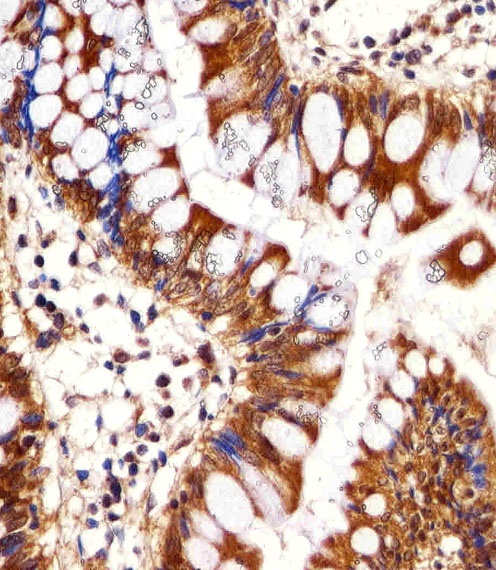 PSMC1 Antibody