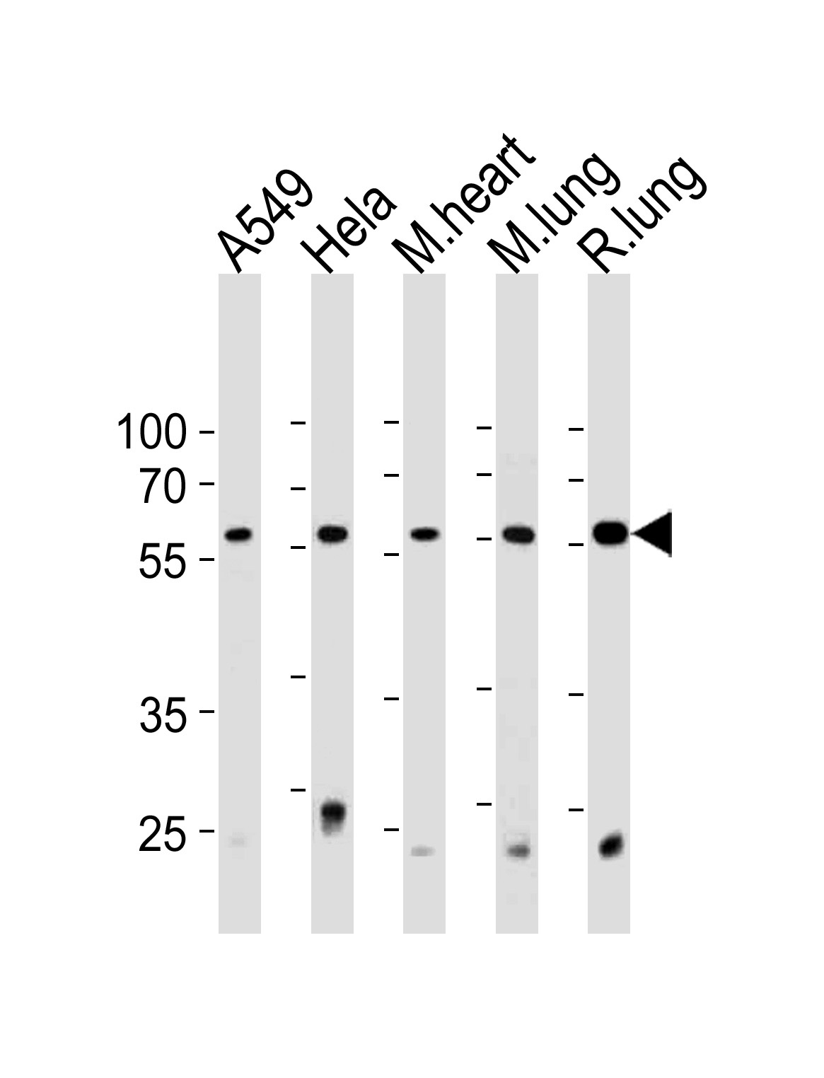 PSMC1 Antibody