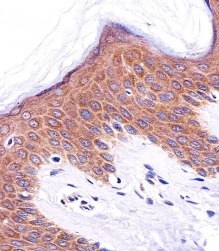 ICT1 Antibody