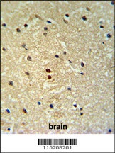 PROX-1-S514 Antibody
