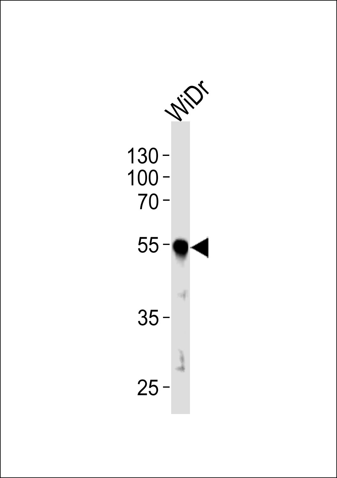 PDX1 Antibody