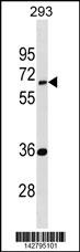 EDC3 Antibody
