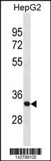 SFXN1 Antibody