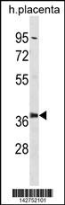 PSMD6 Antibody