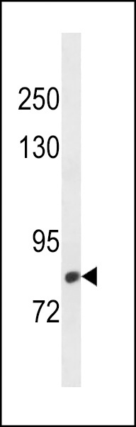CMIP Antibody