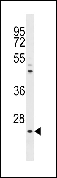NEUROG1 Antibody