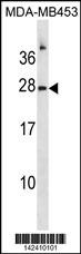 RNASE1 Antibody