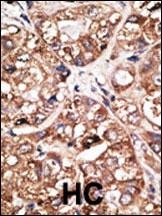 NeuroD1 Antibody