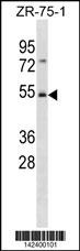 FBXW4 Antibody