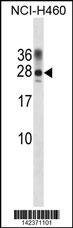 Ppp1r2 Antibody