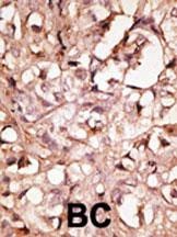 XLKD1 Antibody