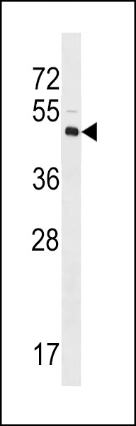 XLKD1 Antibody