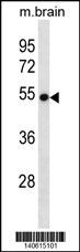 VANGL2 Antibody