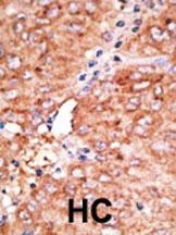 Chemokine Receptor D6 Antibody