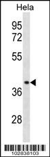 Chemokine Receptor D6 Antibody