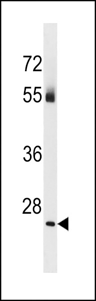 TBC1D26 Antibody