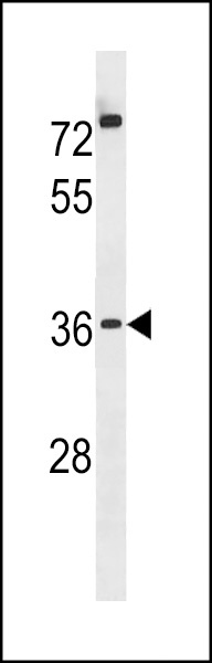 POPDC3 Antibody