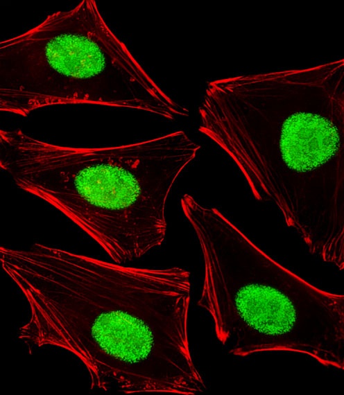 POLDIP3 Antibody