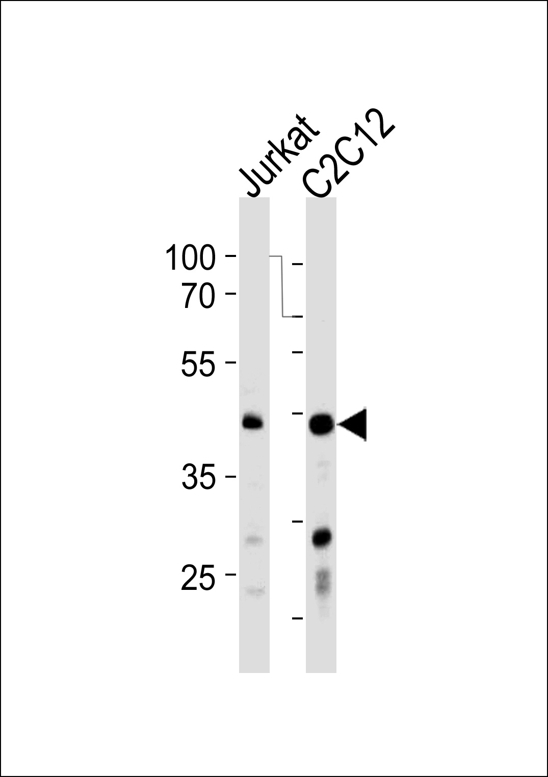 POLDIP3 Antibody