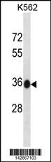 MMACHC Antibody