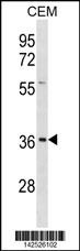 EFNB1 Antibody