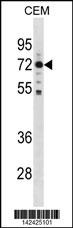 MAK Antibody